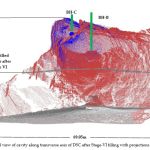 cavity filling after stage vi